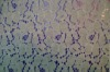 Cotton lace