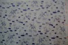 Cotton lace