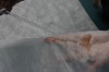 Hydrophile pp nonwoven fabric for diapers