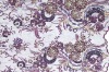New design polyester fabric embroidery with applique and stones
